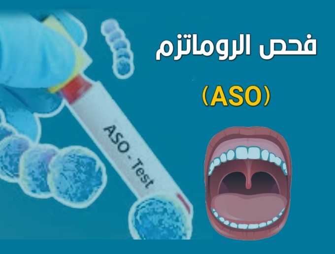 فحص الروماتزم